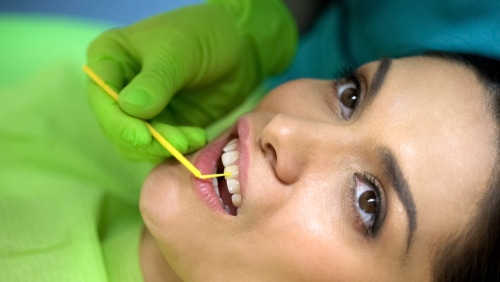 Dental Sealants in Sonora, CA Sonora Dentist Paul Berger, DDS