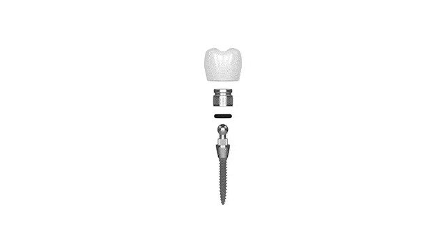 Mini Dental Implant Center of America en Sonora, CA | Implantes Mínimamente Invasivos