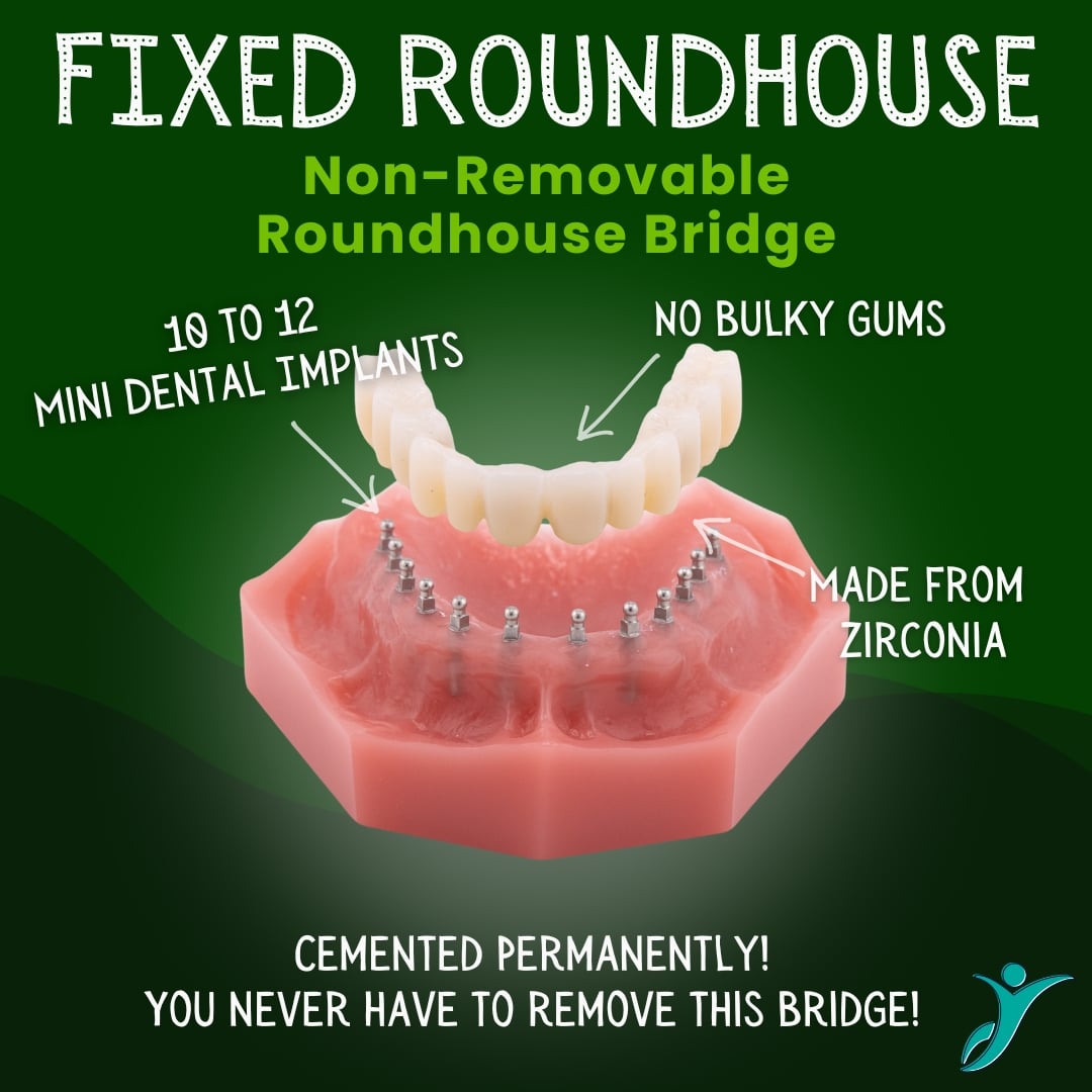 Roundhouse Bridge - Sonora Dentist