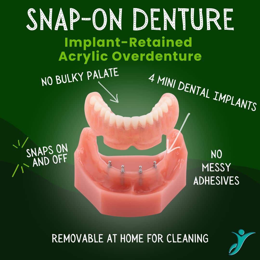 Snap-On Denture in Sonora, CA