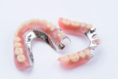 Partial Dentures vs. Implant Bridges in Sonora, CA | [Video Q&A]