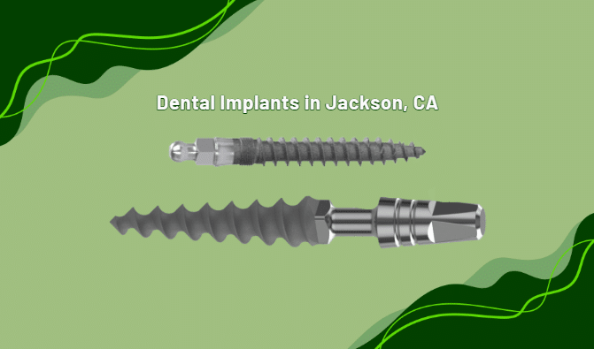 Looking for Dental Implants in Jackson, CA? | Book a Free Implant Consultation!
